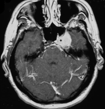 com.bmj.content.model.assessment.Caption@50e2fd82