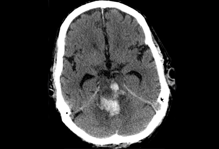 com.bmj.content.model.assessment.Caption@2e0338c0