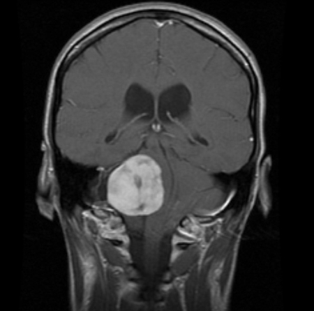 com.bmj.content.model.assessment.Caption@4aacc50a