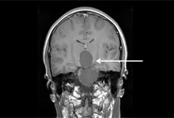 com.bmj.content.model.assessment.Caption@386fc043
