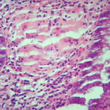 com.bmj.content.model.Caption@634191b2