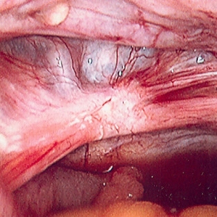 com.bmj.content.model.assessment.Caption@7292c7a8