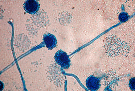 Aspergillosis images