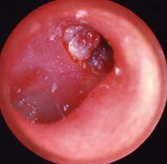 com.bmj.content.model.assessment.Caption@58339210