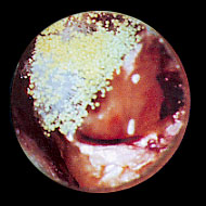 com.bmj.content.model.assessment.Caption@739a3939