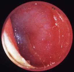 com.bmj.content.model.assessment.Caption@615a8265