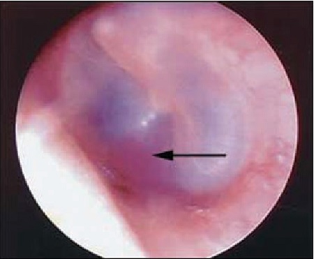 com.bmj.content.model.assessment.Caption@13455eda