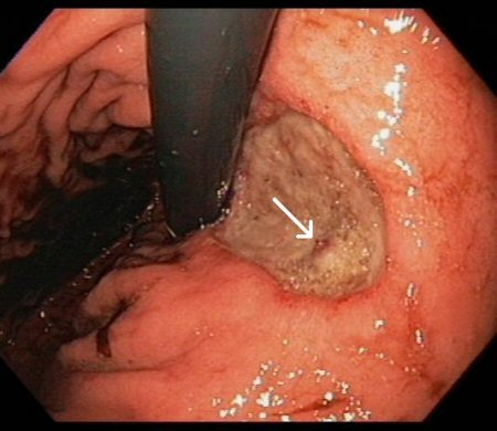 com.bmj.content.model.assessment.Caption@c5869e2
