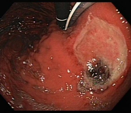 com.bmj.content.model.assessment.Caption@560b716d