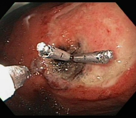com.bmj.content.model.assessment.Caption@314daf39
