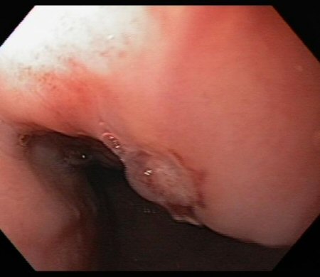 com.bmj.content.model.assessment.Caption@73f2b6c6