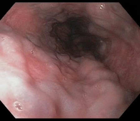 com.bmj.content.model.assessment.Caption@736d2e9b