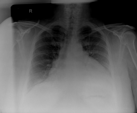 com.bmj.content.model.assessment.Caption@21042f02
