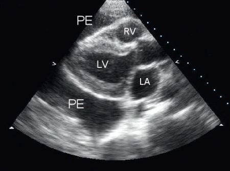 com.bmj.content.model.assessment.Caption@1c699d71