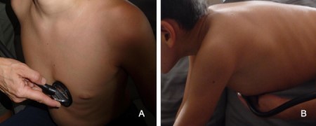 com.bmj.content.model.assessment.Caption@6827dcab