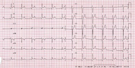 com.bmj.content.model.assessment.Caption@851ae23