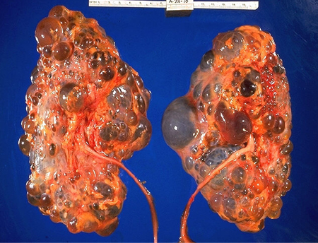 com.bmj.content.model.Caption@4130c653