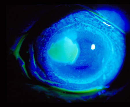 com.bmj.content.model.assessment.Caption@5689ab6c