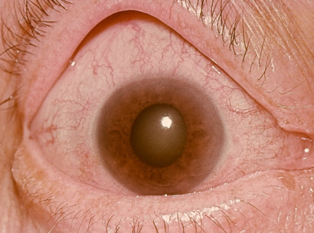 com.bmj.content.model.assessment.Caption@956685a