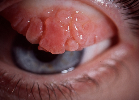 com.bmj.content.model.assessment.Caption@5d9bd766