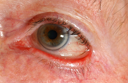 com.bmj.content.model.assessment.Caption@2b68b222