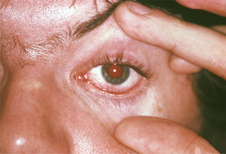 com.bmj.content.model.assessment.Caption@23cf5c78