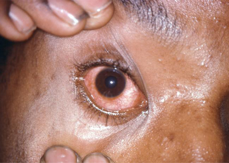 com.bmj.content.model.assessment.Caption@6c8d3fbb