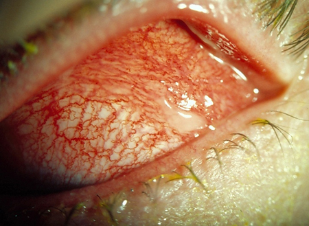 com.bmj.content.model.assessment.Caption@572934a7