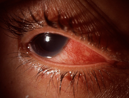 com.bmj.content.model.assessment.Caption@570cd9a7