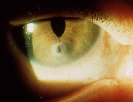 com.bmj.content.model.assessment.Caption@1324106c