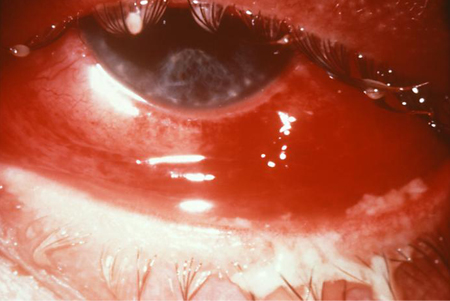com.bmj.content.model.assessment.Caption@111573d7