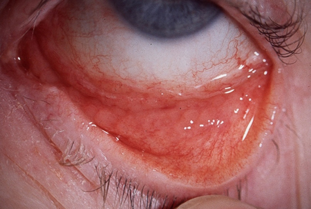 com.bmj.content.model.assessment.Caption@76c5a812