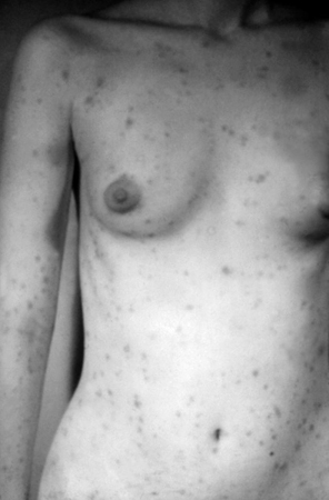 com.bmj.content.model.Caption@40553f0