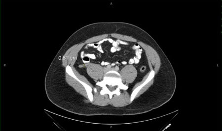 com.bmj.content.model.assessment.Caption@153f7d7