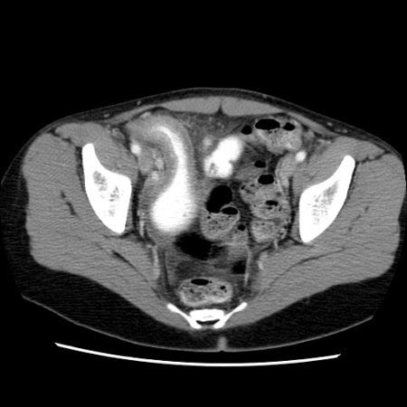 com.bmj.content.model.assessment.Caption@70083edb