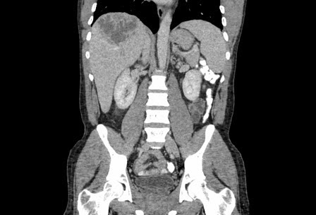 com.bmj.content.model.assessment.Caption@7d934a84