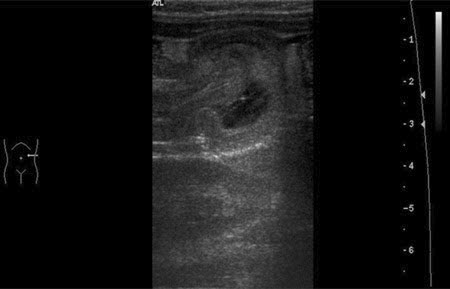 com.bmj.content.model.assessment.Caption@48abc4ff