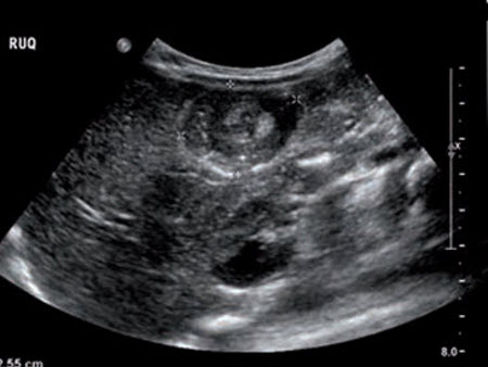 com.bmj.content.model.assessment.Caption@38a8a7b0