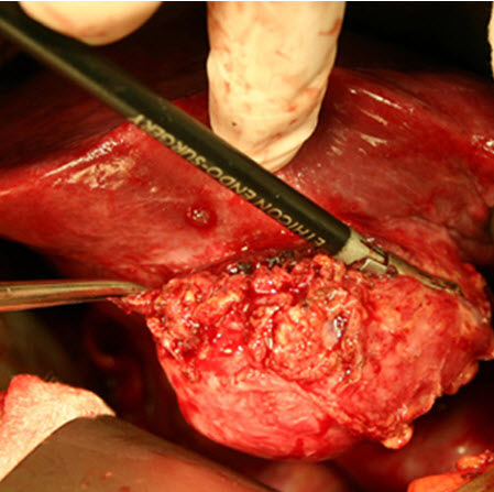 com.bmj.content.model.assessment.Caption@51d588a9