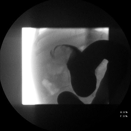 com.bmj.content.model.assessment.Caption@25d01f2b