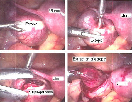 com.bmj.content.model.assessment.Caption@5c82906