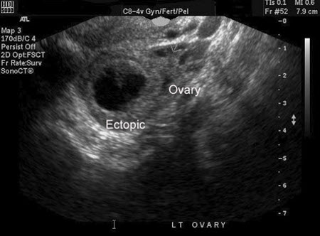 com.bmj.content.model.assessment.Caption@3c168658