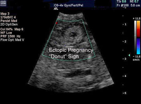 com.bmj.content.model.assessment.Caption@16eda961
