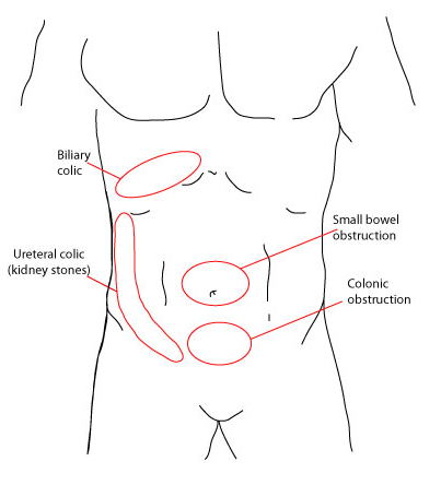 com.bmj.content.model.assessment.Caption@5f9d9adc