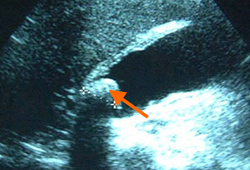 Assessment of acute abdomen images