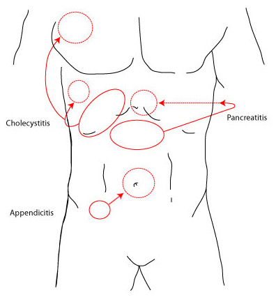 com.bmj.content.model.assessment.Caption@3435de24