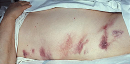 com.bmj.content.model.assessment.Caption@6dc2c6f2