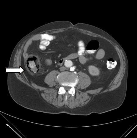 com.bmj.content.model.assessment.Caption@274b75b