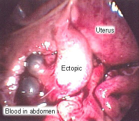 com.bmj.content.model.assessment.Caption@631cd40f