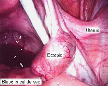 com.bmj.content.model.assessment.Caption@3dca737c